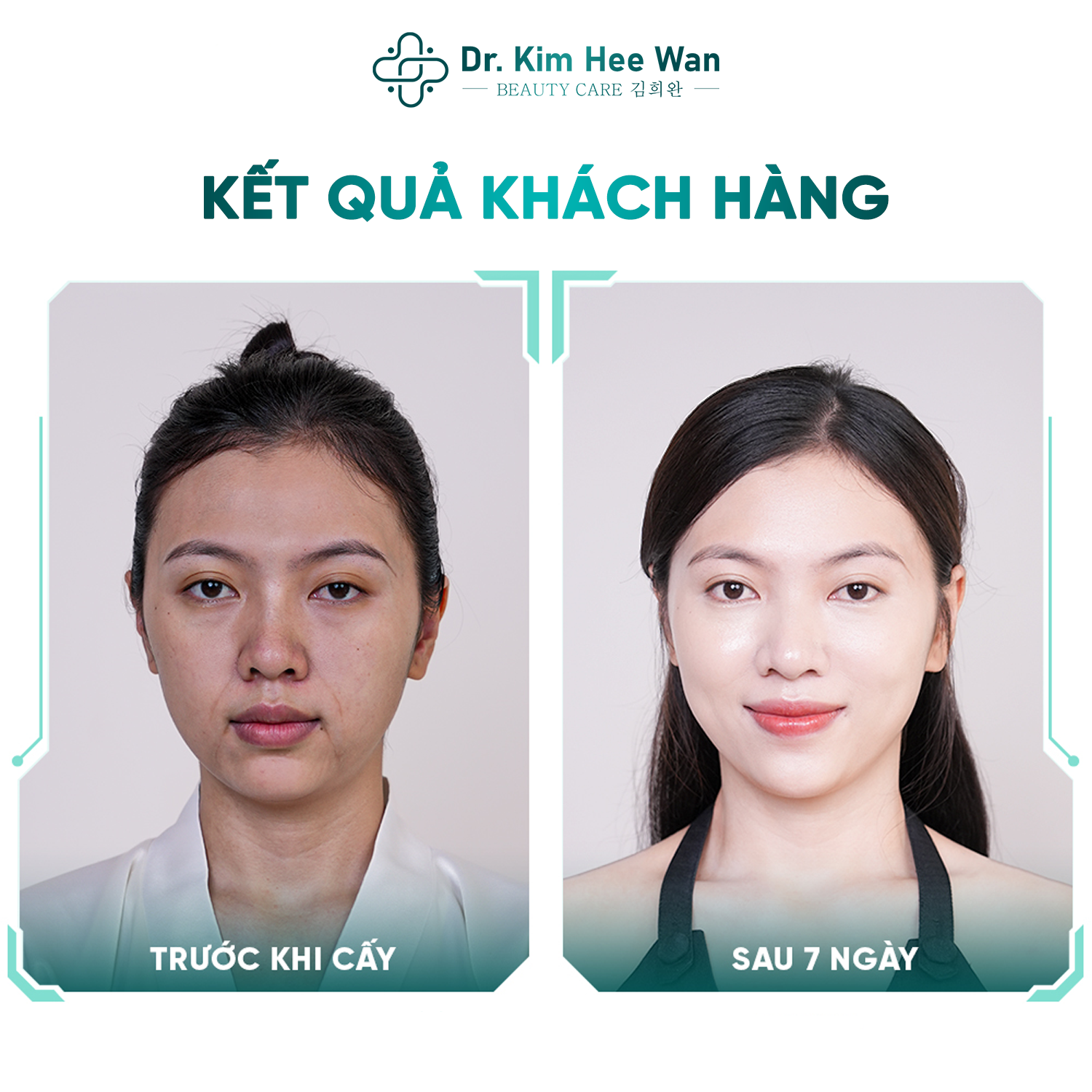 hinh-2-1749631351.png