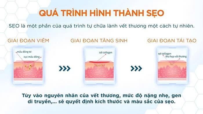 tri-seo-som-giup-tiet-kiem-thoi-gian-va-chi-phi1-1754977030.jpg