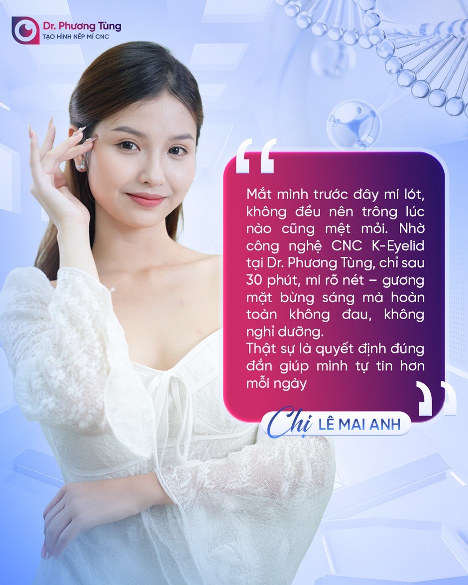 dep-mi-khong-can-dao-keo3-1758097406.jpg