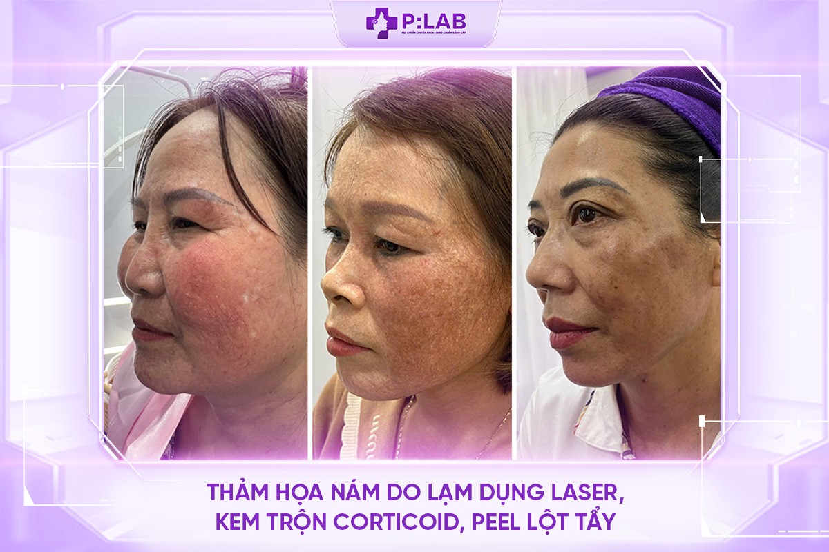 27-10-8-anh-tinh-trang-di-bao-1787542096.jpg