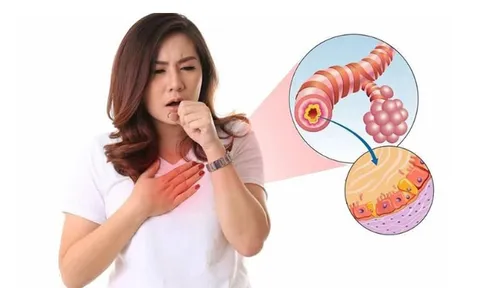 Kẻ thù thực sự của bệnh viêm phế quản chính là yến sào