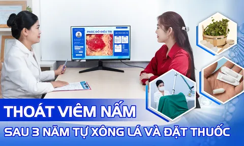 Từng tự xông lá, đặt thuốc tại nhà nhưng không khỏi, người phụ nữ 38 tuổi thoát viêm nấm tái phát sau khi điều trị đúng cách