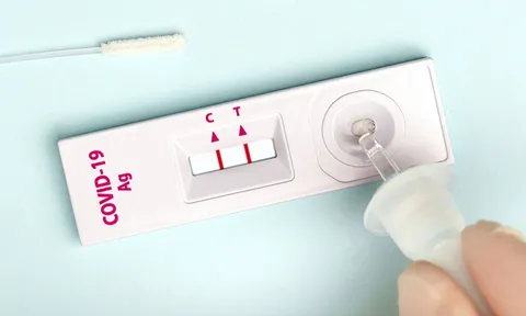 Tái nhiễm Covid-19 có phổ biến không? Ai có nguy cơ cao? Con số biết nói từ Anh