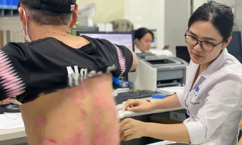 Khám miễn phí bệnh vảy nến