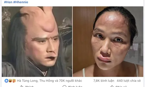 H'Hen Niê tiết lộ bị nổi mề đay sau sinh, bác sĩ nói gì về tình trạng này?
