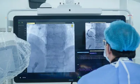 Nhồi máu cơ tim cấp mà tưởng đau ngực bình thường