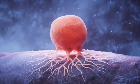 Tìm ra loại thuốc đầu tiên chống được "RNA bất tử" của ung thư