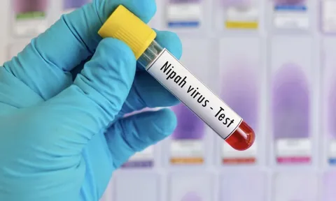 TPHCM tăng cường giám sát nhập cảnh, kiểm soát dịch bệnh Nipah