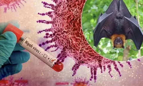 Sở Tp.HCM thông tin về tình hình, phương án phòng chống bệnh do virus Nipah