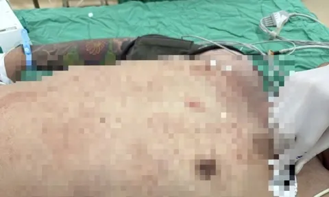 Cứu sống 1 nam bệnh nhân nguy kịch do thủng tim