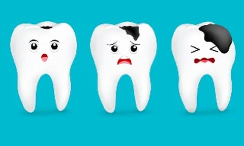 Vi khuẩn răng miệng gây tổn hại đến mức nào?