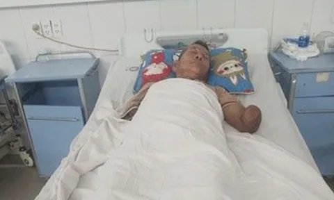 Tin mới liên quan cụ ông cụt 2 tay kẹp con rắn hổ mang dài 2 mét