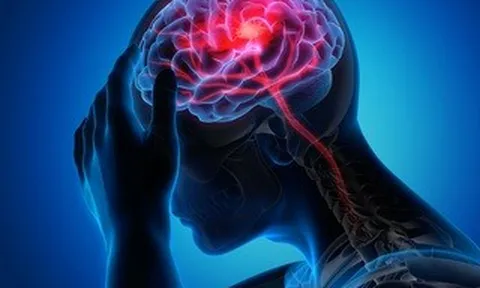 Nghiên cứu 53.000 người chỉ ra 3 cách ngăn ngừa đột quỵ đơn giản