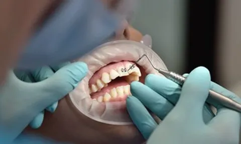 Mỗi hàm răng một phác đồ riêng nhờ nha khoa cá nhân hóa