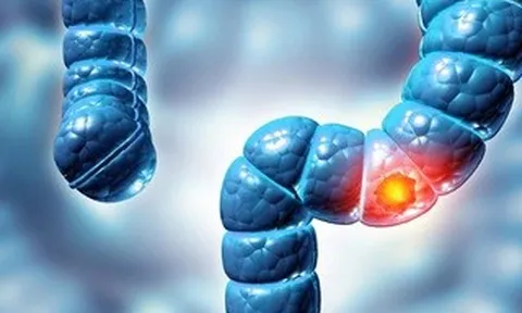 Phát hiện virus mới liên quan loại bệnh ung thư phổ biến