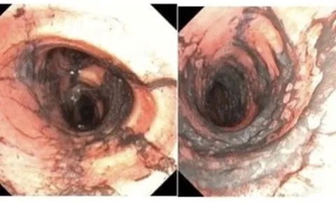Ngạt khói nặng sau vụ cháy, đôi vợ chồng trẻ được hồi phục kỳ diệu