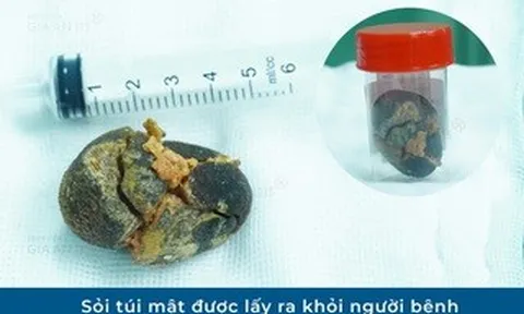 Đi khám sức khỏe định kỳ, người phụ nữ trẻ phát hiện điều bất ngờ