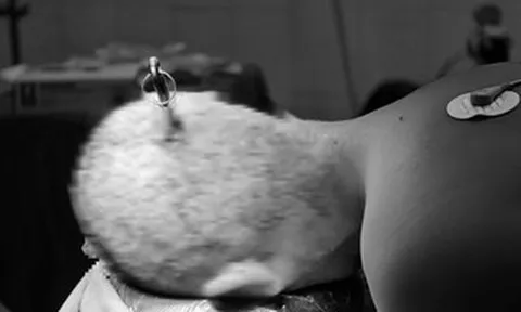 Hai học sinh nhập viện vì tai nạn học đường từ trò đùa nghịch