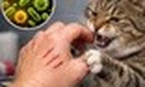 Cháu bé 5 tuổi tử vong sau 4 tháng bị mèo cào vào tay và chó cắn trượt da