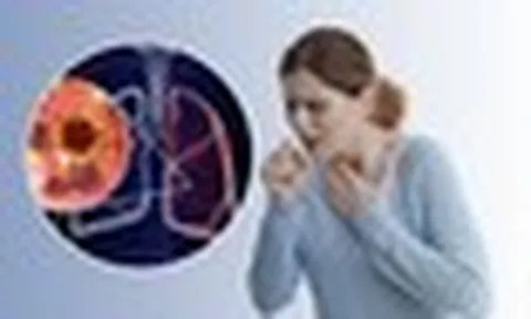 Không hút thuốc vẫn bị ung thư phổi: 2 yếu tố hầu như ai cũng gặp mỗi ngày