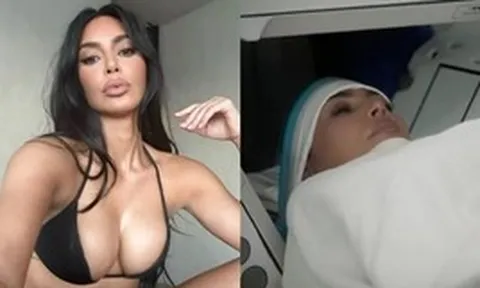 “Kim siêu vòng 3” bị phình mạch máu não