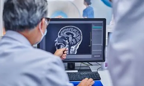 Cảnh báo: Nguy cơ đột quỵ tăng 86% ở những người có đặc điểm này ở miệng