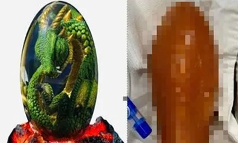 Người đàn ông nhập viện sau khi sử dụng đồ chơi tình dục “Trứng Rồng”