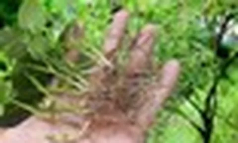 Uống lá đinh lăng, rễ lá lốt, người đàn ông cấp cứu vì không thể đi lại