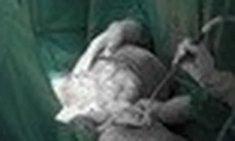 Bụng to như mang thai 9 tháng, người phụ nữ phát hiện thứ khủng khiếp bên trong