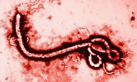 WHO nâng mức cảnh báo dịch Ebola lên khẩn cấp, Bộ Y tế lên tiếng