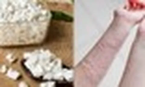 Trong nhà có bột sắn dây: Pha ngay theo cách này để cơ thể THẢI ĐỘC, đánh bay mẩn nNgứa, mề đay mùa nắng nóng
