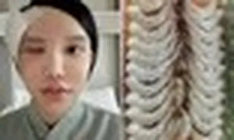 Người phụ nữ bị ký sinh trùng bò vào hốc mắt, suýt mù, bác sĩ cảnh báo 1 thói quen nhiều người Việt mắc phải