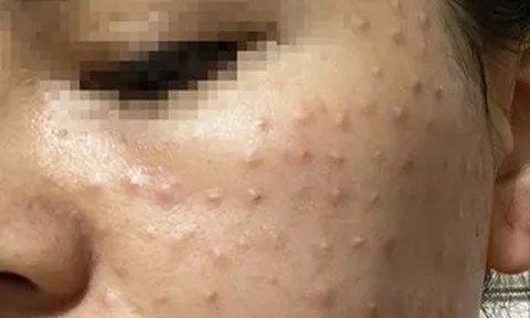 Cảnh báo lạm dụng thẩm mỹ theo mạng xã hội