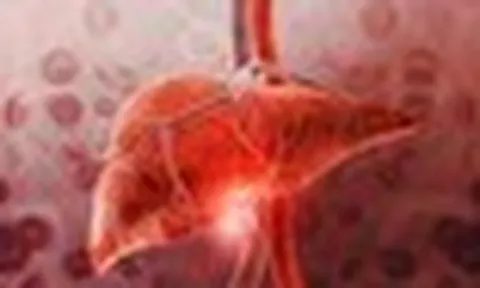 1 thói quen giải khát "bức tử" lá gan: Nhiều người Việt đang làm mỗi ngày