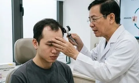 Người trẻ rụng tóc, hói đầu vì những thói quen tưởng vô hại