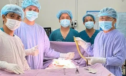Hy hữu: Phẫu thuật lấy con lươn dài 50 cm chui vào bụng một bệnh nhân