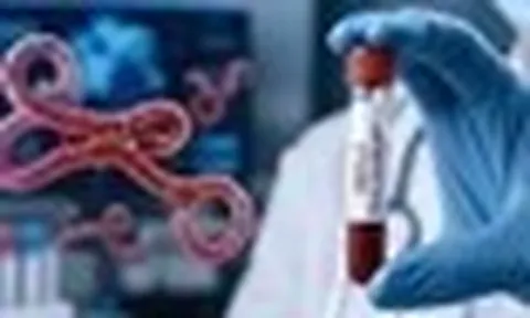 Bộ Y tế kích hoạt giám sát dich Ebola, tăng cường ngăn dịch xâm nhập