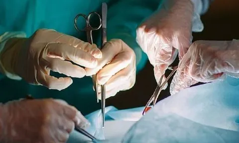 Nhập viện vì đau bụng, người đàn ông 67 tuổi sốc nặng khi bác sĩ gắp ra thứ "đáng sợ" đen sì