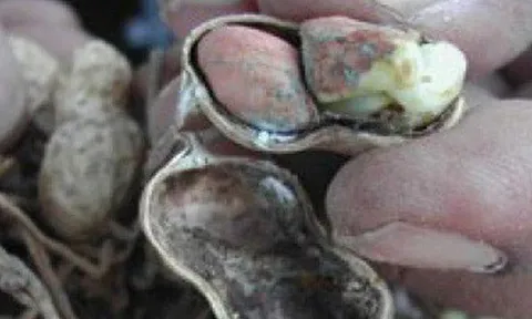 Loại hạt để mốc hại gan, "độc hơn thạch tín", nhiều người không biết vẫn vô tư ăn