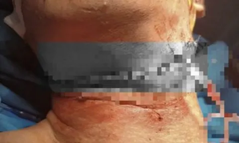 Nam thanh niên ở Cần Thơ gặp tai nạn khó tin