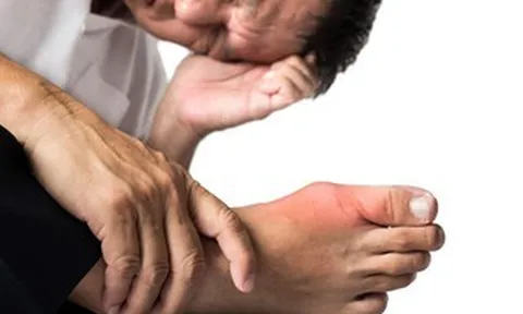 Chuyên gia Harvard: Người bệnh gout nên ăn gì?