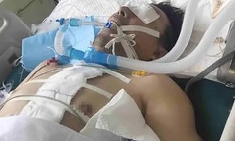 Người đàn ông nguy kịch vì trắng xóa cả 2 bên phổi: Bác sĩ cảnh báo 1 kiểu dùng điều hòa ngang "tự sát"