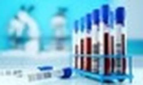 5 xét nghiệm nên làm khi bước sang tuổi 35