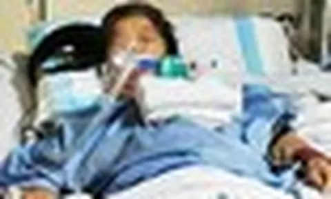 Người phụ nữ bị xuất huyết não, hôn mê sau khi uống canh đậu xanh liên tục trong 3 ngày
