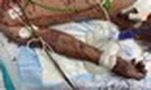 Bác sĩ Bệnh viện Nhi đồng TP.HCM đau lòng kể bé trai 10 tuổi tử vong chỉ sau 1 ngày đau đầu: Cảnh báo căn bệnh diễn tiến rất nhanh phụ huynh ám ảnh