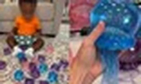 Cảnh báo về món đồ chơi hot Tiktok hàng triệu người đang mua: Con chỉ làm theo một video trên mạng, hậu quả là bỏng mặt và cánh tay
