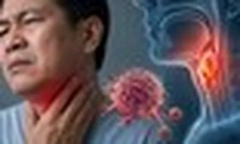 Bác sĩ cảnh báo: 6 DẤU HIỆU bất thường ở cổ họng có thể liên quan đến ung thư, nhiều người nhầm là viêm họng thông thường