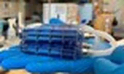850 triệu người mắc bệnh thận: Việt Nam đang ở đâu giữa cuộc đua nghìn tỉ USD "thận nhân tạo" trên thế giới?