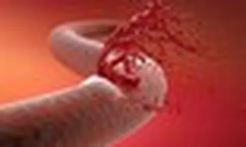 29 tuổi, mạch máu có thể vỡ bất cứ lúc nào: Do hàng loạt thói xấu kéo dài