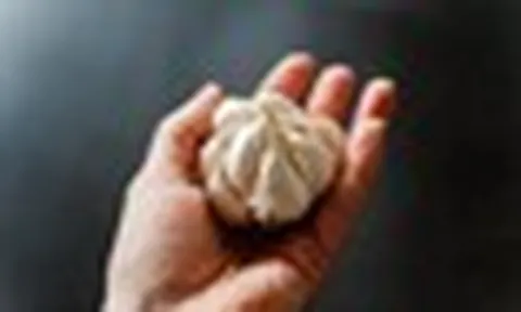 Nhiều người ăn tỏi để “thải độc” gan: Chuyên gia chỉ ra sự thật không phải ai cũng biết